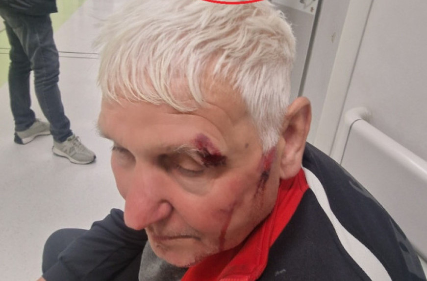 Dok Šarović glumi žrtvu, deka zbog "kore od banane" završio krvav u hodniku Urgentnog