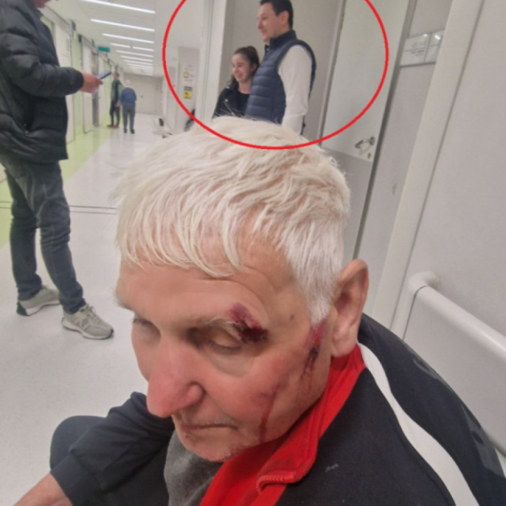 Dok Šarović glumi žrtvu, deka zbog "kore od banane" završio krvav u hodniku Urgentnog