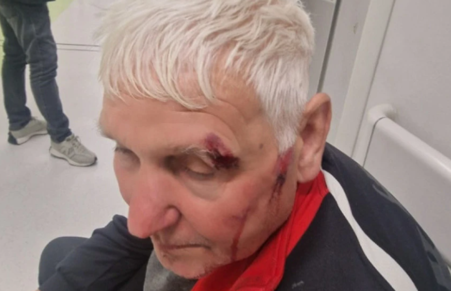 Nasilje blokadera ne prestaje; Povređen stariji čovek, užasne fotografije FOTO