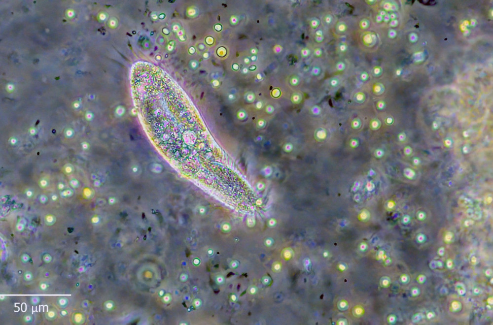 "Ekologija vaskrsnuća": Naučnici oživeli alge stare 7.000 godina FOTO