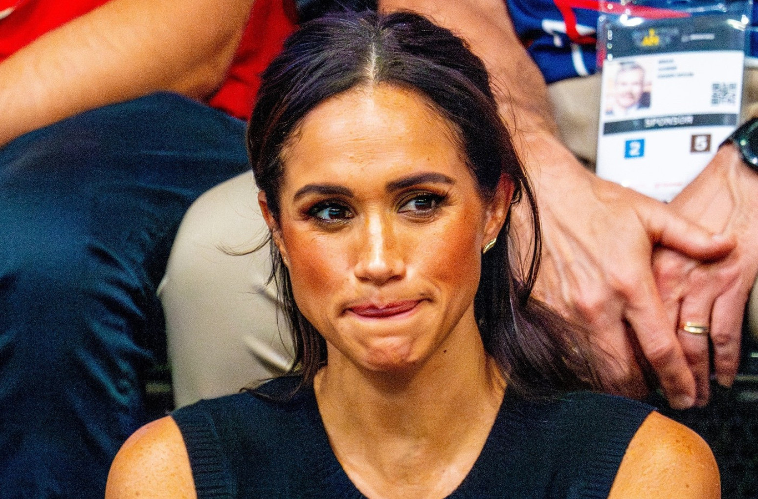 Nije bilo alternative... Ocu Megan Markl amputirana noga