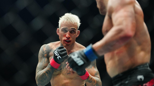 "Govorili su da nemam ruke"