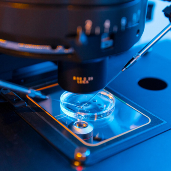 Veštačka inteligencija leči neplodnost kod muškaraca: Lov na zdrave spermatozoide FOTO