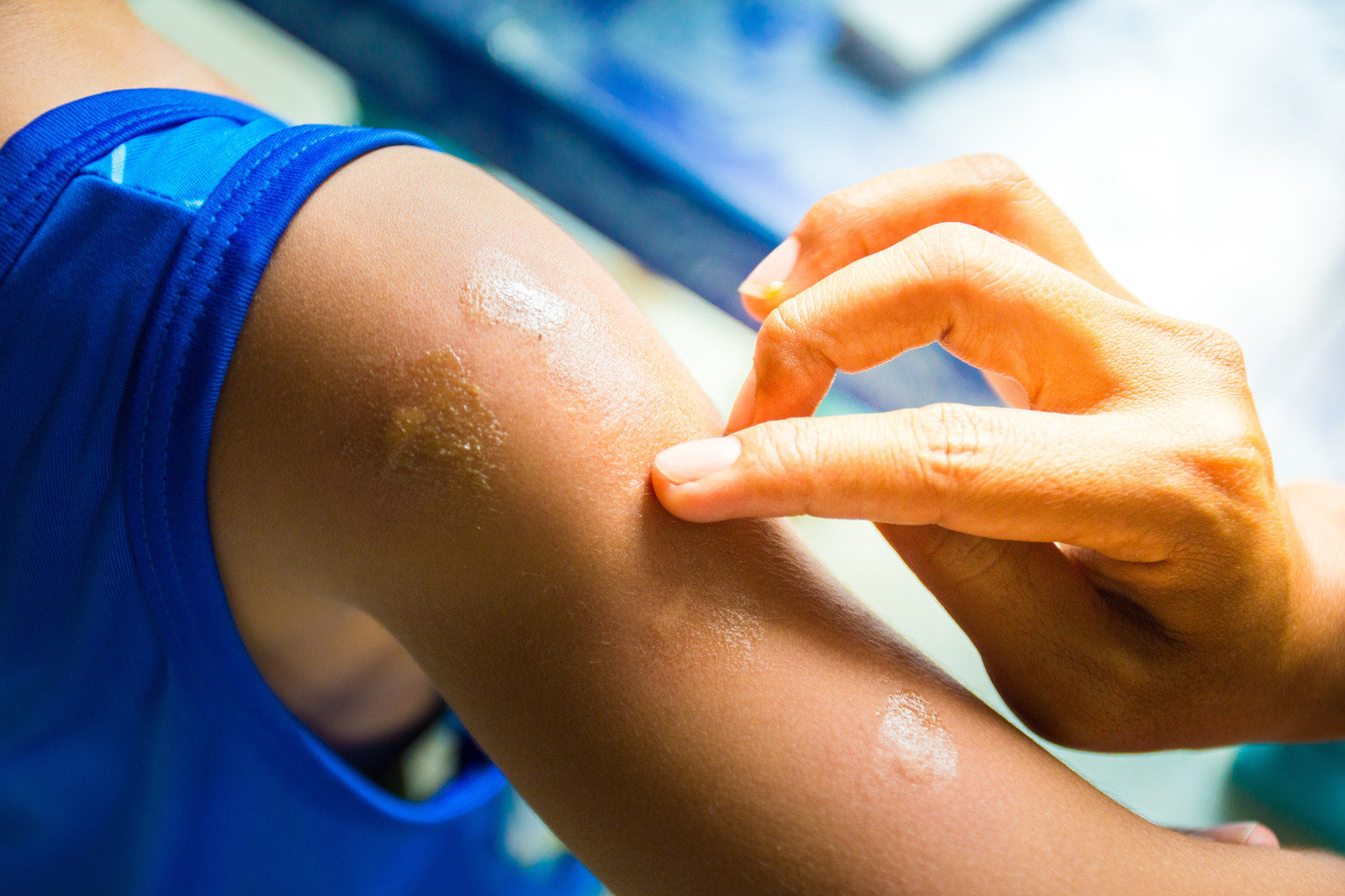 Opasan virus širi se Evropom, a za njega nema leka ni vakcine: Evo gde je najviše zaraženih