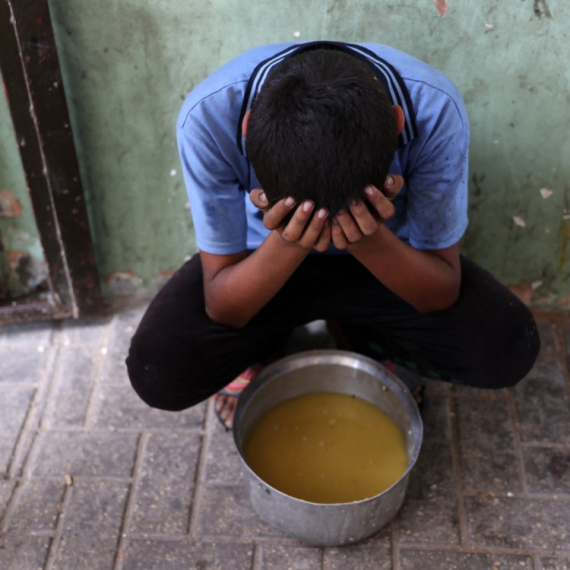 Užas u Gazi: Deci pogođenoj pothranjenošću preti smrt bez hitne pomoći