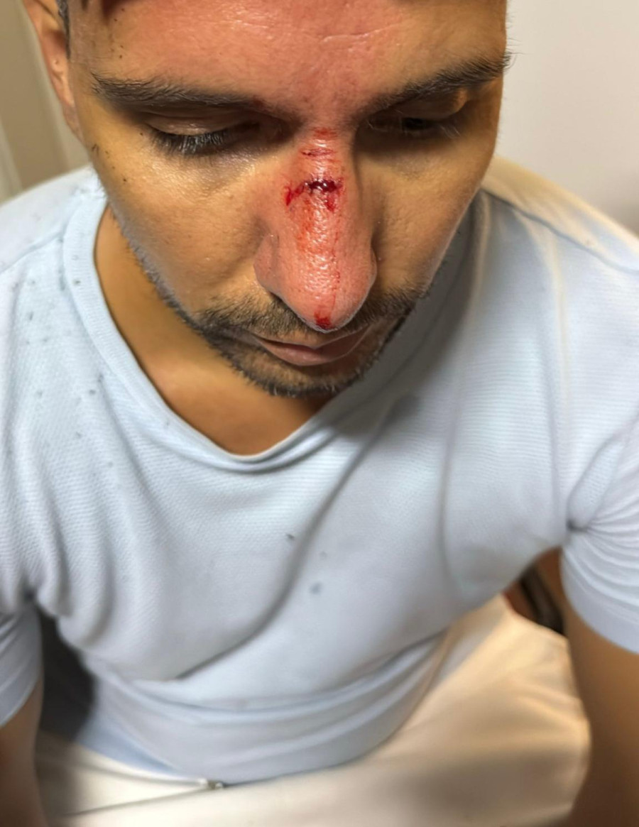 Nasilje ne prestaje: Pogodili mladića kamenicom u glavu FOTO/VIDEO