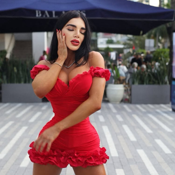 Zbog korseta joj se pomerili unutrašnji organi: Ne skida ga 23 sata dnevno FOTO