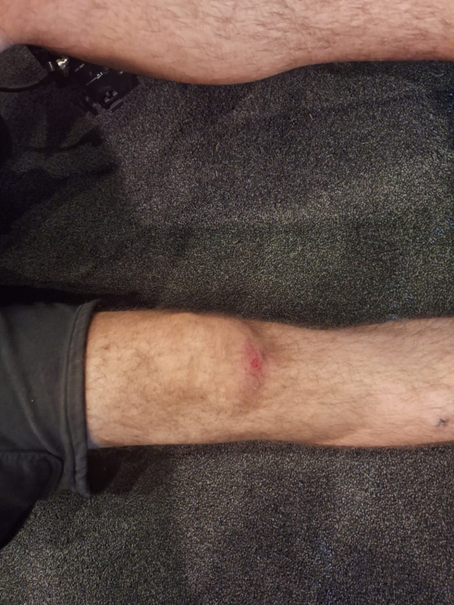 Blokaderi napali ekipu Informera u Novom Sadu; Ima povređenih, traži se hitna reakcija FOTO/VIDEO