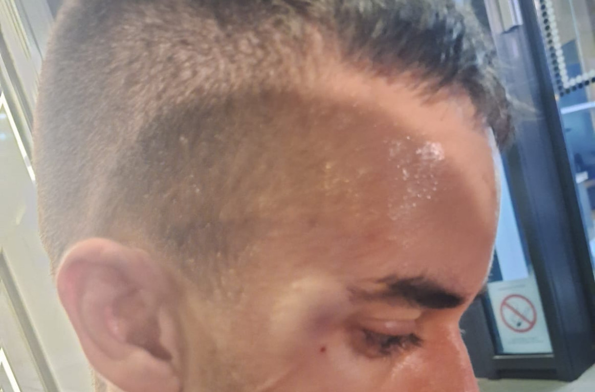 Blokaderi napali ekipu Informera u Novom Sadu; Ima povređenih, traži se hitna reakcija FOTO/VIDEO