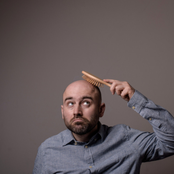 Da li epitet "ćelavi" predstavlja seksualno uznemiravanje? Slučaj pokrenuo raspravu ANKETA/VIDEO