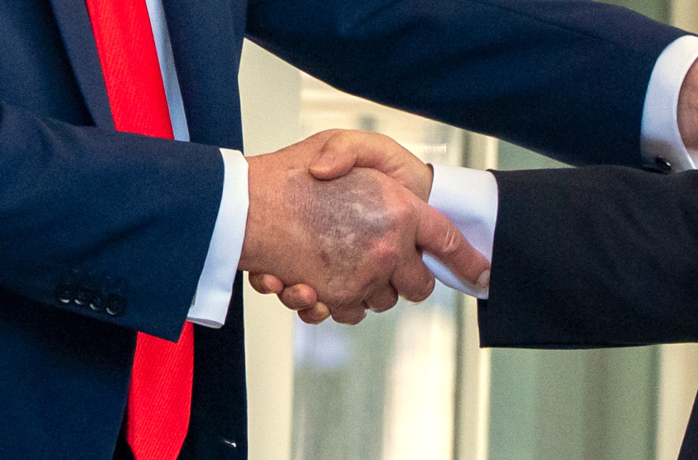 Nova modrica na Trampovoj ruci: "Potvrđeno je..." FOTO