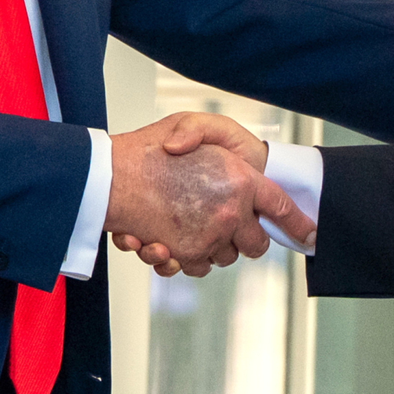 Nova modrica na Trampovoj ruci: "Potvrđeno je..." FOTO