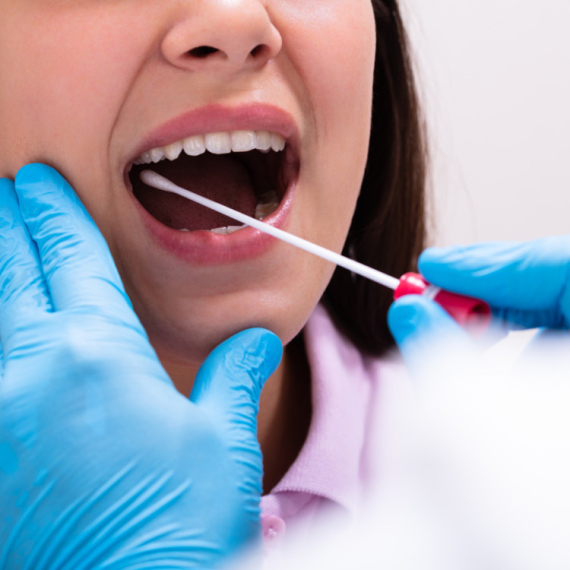 Može da vam spasi život: Samo jedan bris otkriva od čega možete da obolite VIDEO