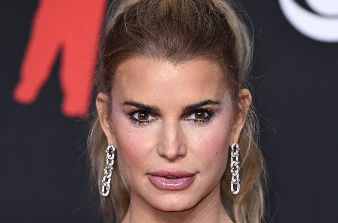 Pevačica neprepoznatljiva: "Šta joj se desilo? Alergija?" FOTO/VIDEO