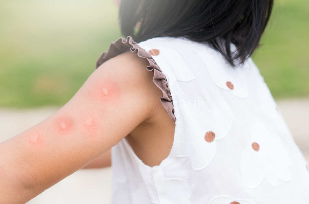 Opasan virus se i dalje širi Srbijom: Najviše obolelih u ovom gradu