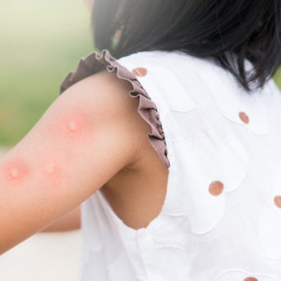 Opasan virus se i dalje širi Srbijom: Najviše obolelih u ovom gradu