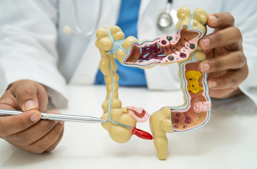 Ova vrsta raka je u porastu: Naučnici nemaju odgovor, mladi sve češće obolevaju