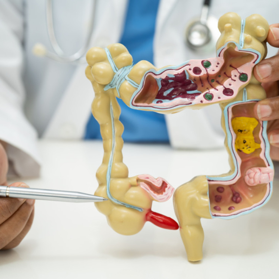 Ova vrsta raka je u porastu: Naučnici nemaju odgovor, mladi sve češće obolevaju