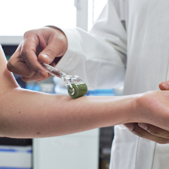 Više od bola u zglobovima: Prepoznajte rane znake bolesti koja okupira više organa