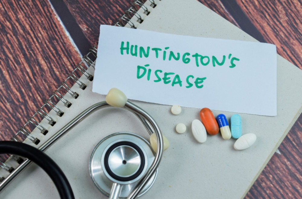 Hantingtonova bolest prvi put uspešno izlečena: "Spektakularni rezultati" FOTO