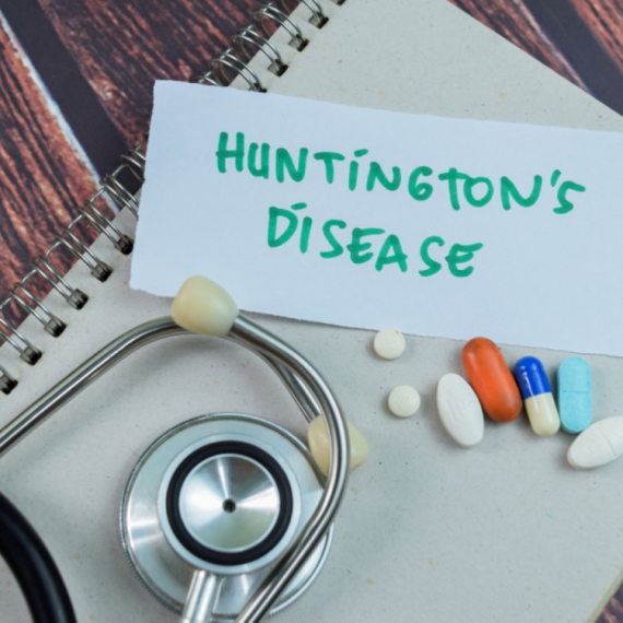 Hantingtonova bolest prvi put uspešno izlečena: "Spektakularni rezultati" FOTO