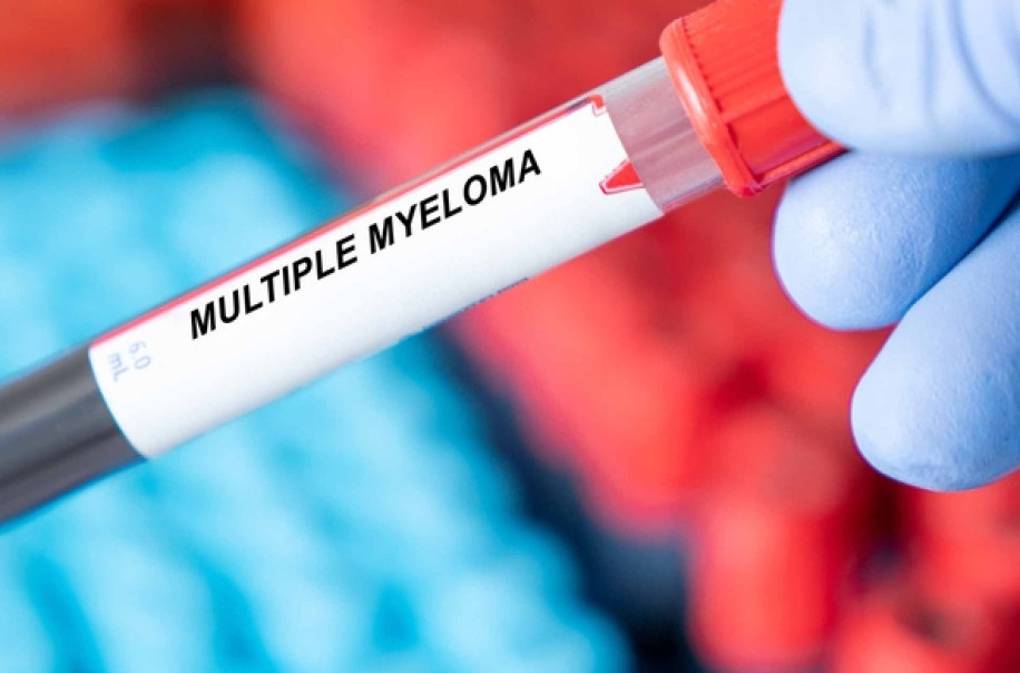 Dijagnozu multiplog mijeloma, raka krvi, godišnje dobije 500 ljudi u Srbiji