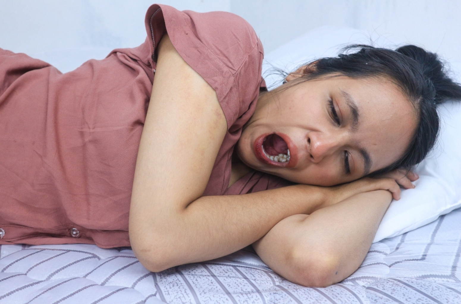 Toliko je zevala da je slomila vrat: "Neobična nesreća" užasnula mnoge FOTO