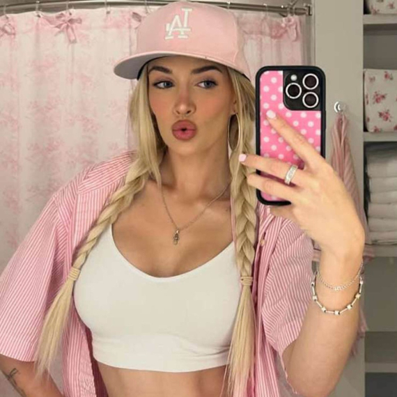 Ćerka Čarlija Šina objavila "pre i posle" fotku: "Hvala Bogu na plastičnim operacijama" FOTO