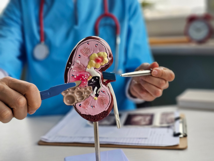 U Srbiji 700.000 ljudi živi sa ovom hroničnom bolešću: Jedna stvar je najveći izazov u lečenju