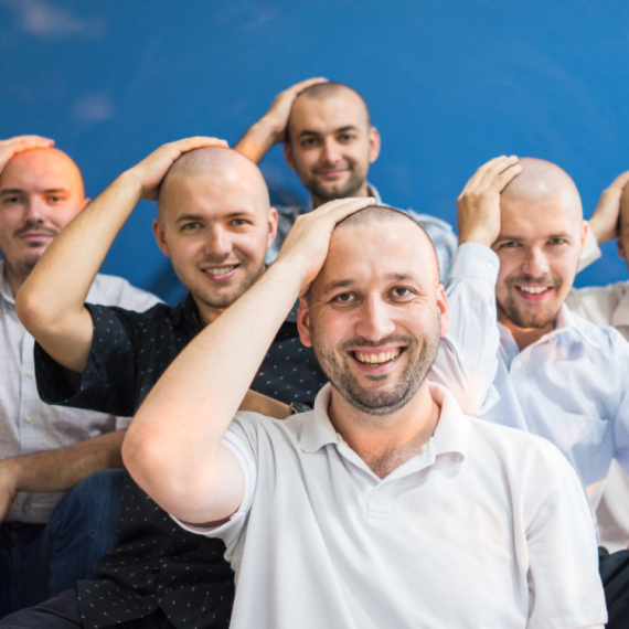 Ljudi se masovno šišali do glave zbog vanzemaljaca VIDEO