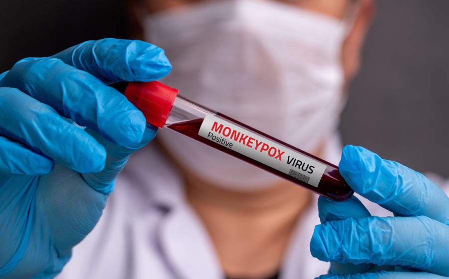 Širi se, ne dopustite da vas iznenadi epidemija