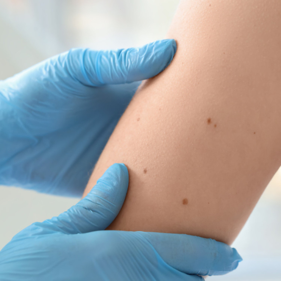 Više od 160 hiljada ljudi u Srbiji boluje od ove bolesti: Doktor apeluje na jedno VIDEO