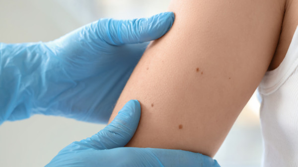 Više od 160 hiljada ljudi u Srbiji boluje od ove bolesti: Doktor apeluje na jedno VIDEO