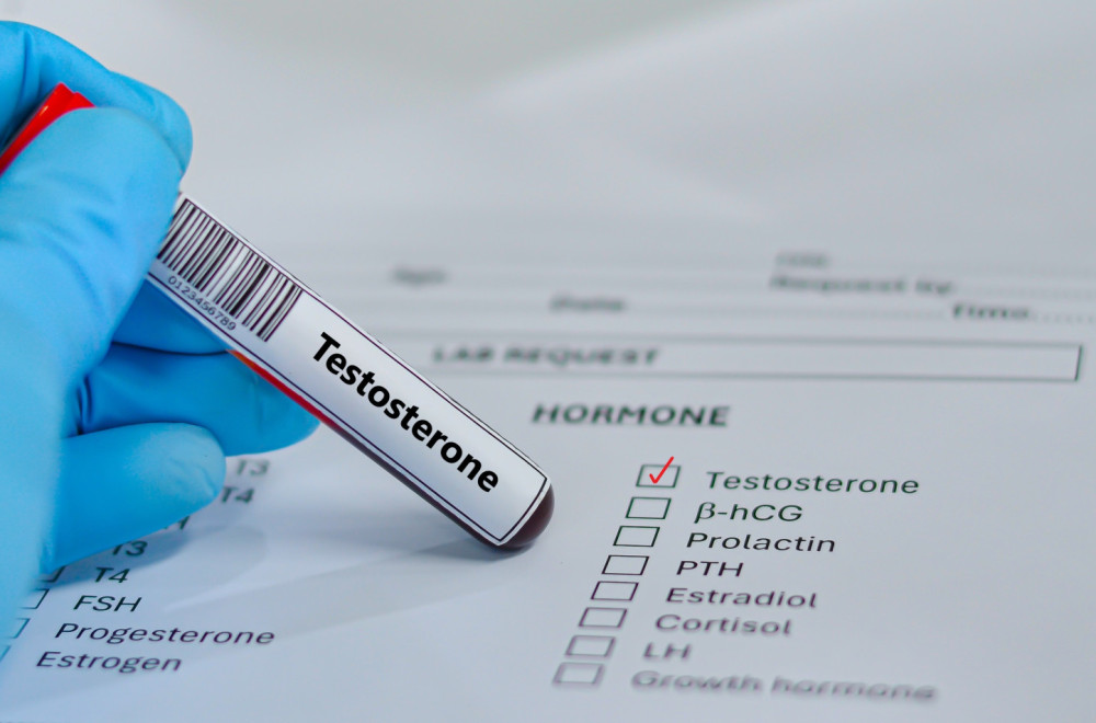 Sve više muškaraca traži terapiju testosteronom: Lekari apeluju na ozbiljan problem