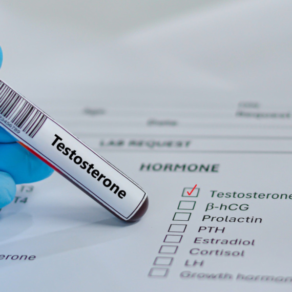 Sve više muškaraca traži terapiju testosteronom: Lekari apeluju na ozbiljan problem