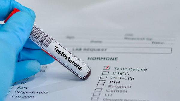 Sve više muškaraca traži terapiju testosteronom: Lekari apeluju na ozbiljan problem