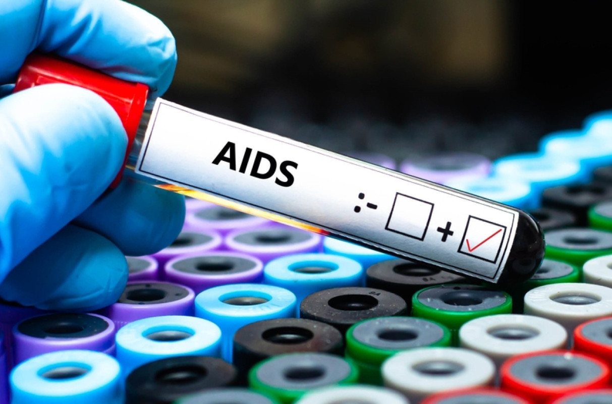HIV registrovan kod 1,3 miliona ljudi: Od side umrlo 630.000 osoba