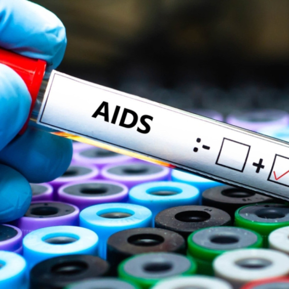 HIV registrovan kod 1,3 miliona ljudi: Od side umrlo 630.000 osoba