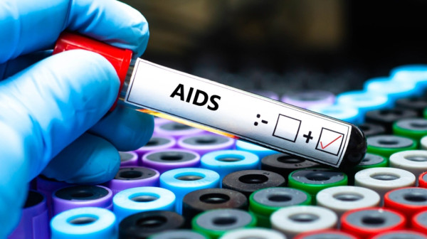HIV registrovan kod 1,3 miliona ljudi: Od side umrlo 630.000 osoba