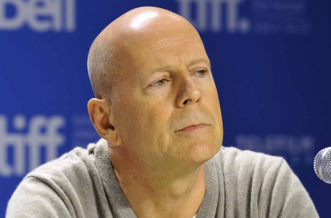 Nema leka, brzo napreduje: Srpski lekar o bolesti Brusa Vilisa i odluci porodice VIDEO