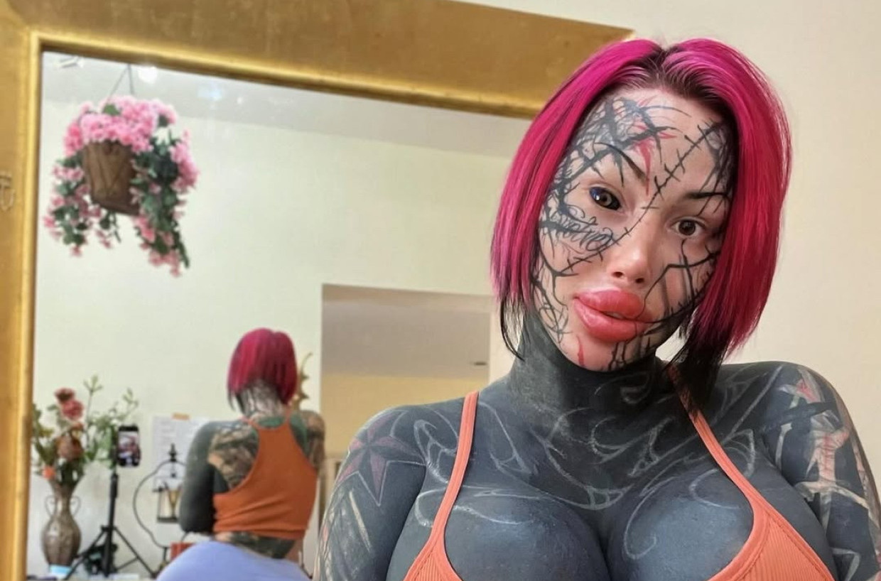 Preminula "kraljica" plastičnih operacija