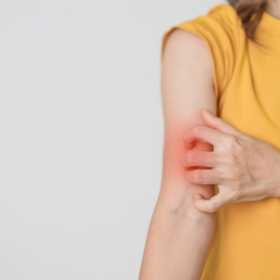 Lepra se širi u Rumuniji: Nulti pacijent Azijatkinja; poznati svi detalji