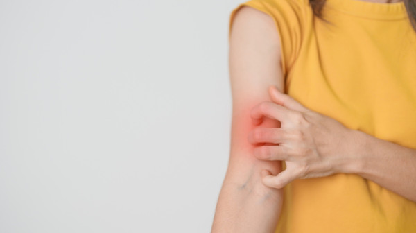 Oglasio se Batut zbog lepre