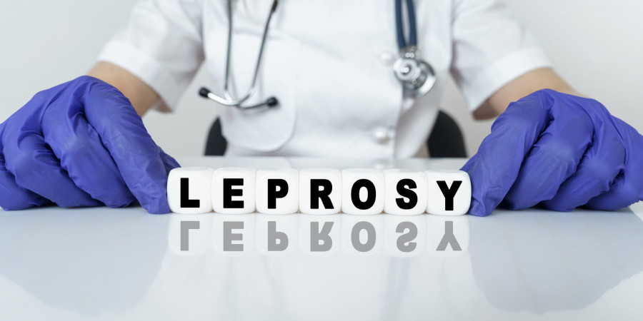 Poznato stanje pacijenta zaraženog leprom: Celo telo flekavo, evo da li može doći do epidemije