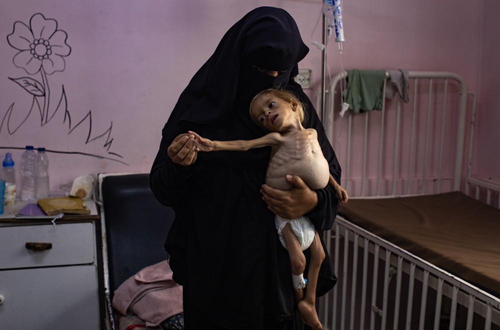 Fotografija koja pokazuje u kakvom svetu živimo: Pogled koji opominje FOTO