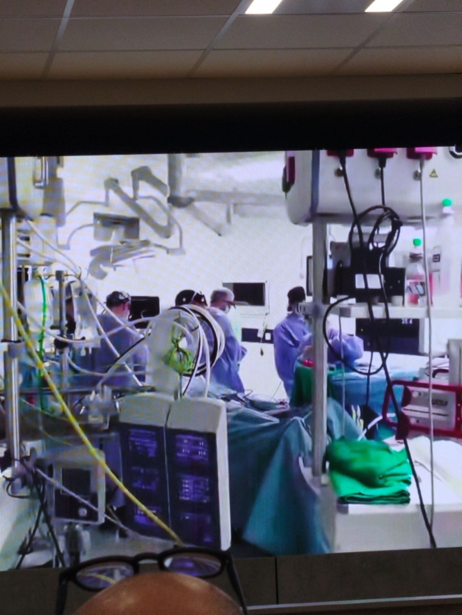 Velik podvig: U Srbiji urađena operacija na srcu uz pomoć robota; Bez krvarenja i trauma FOTO