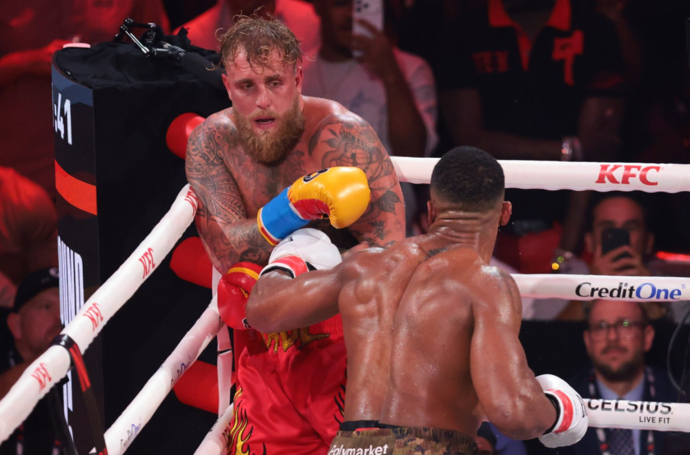 Da li biste dozvolili da vam polome vilicu za 92 miliona dolara? Da FOTO