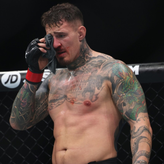 UFC šampion mora na operaciju oka: "Sve ću mu naplatiti"