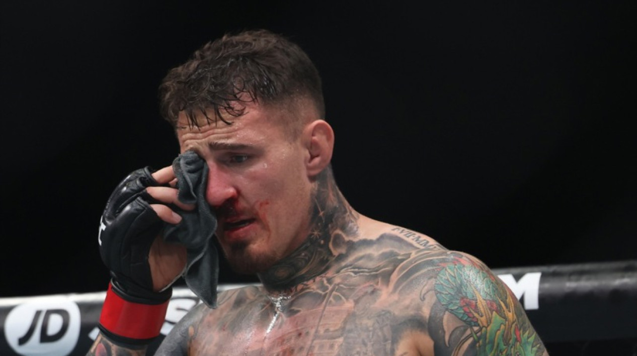 UFC šampion mora na operaciju oka: "Sve ću mu naplatiti"