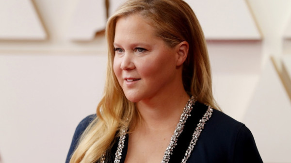 Poznata glumica boluje od Kušingovog sindroma: Evo kako se ispoljava ovo retko stanje